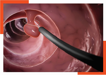 Colorectal