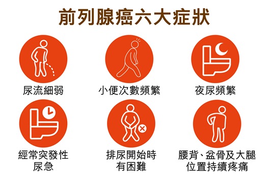 Symptoms of prostate cancer