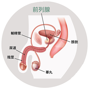 Prostate cancer