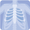 lung cancer