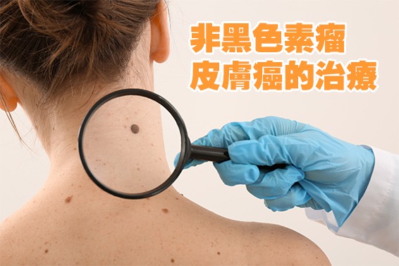 skin cancer