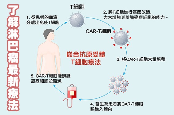 Lymphoma