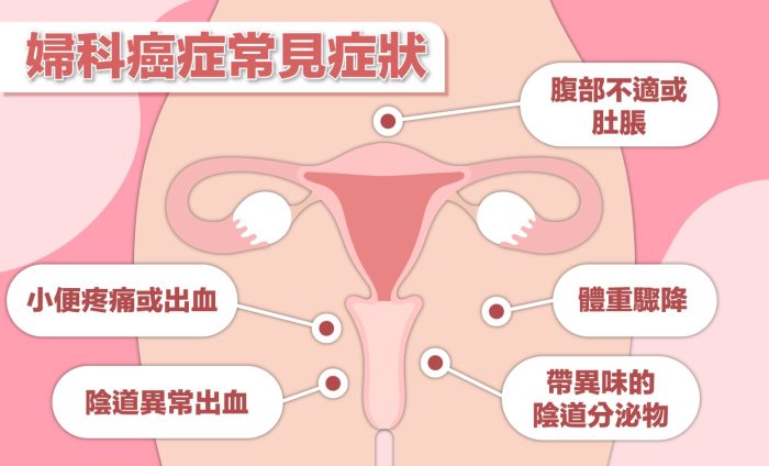 gynae cancer symptoms