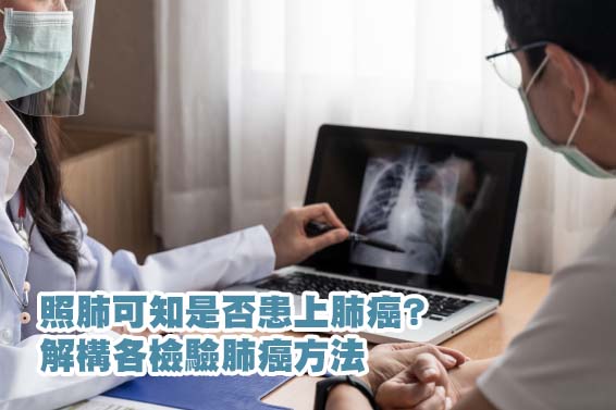 lung cancer