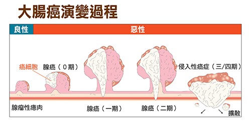 Colorectal